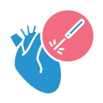 Vascular Surgery