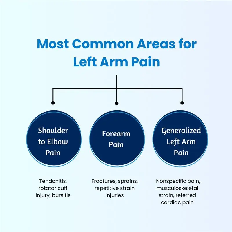 e ICD-10 Code for Left Arm Pain