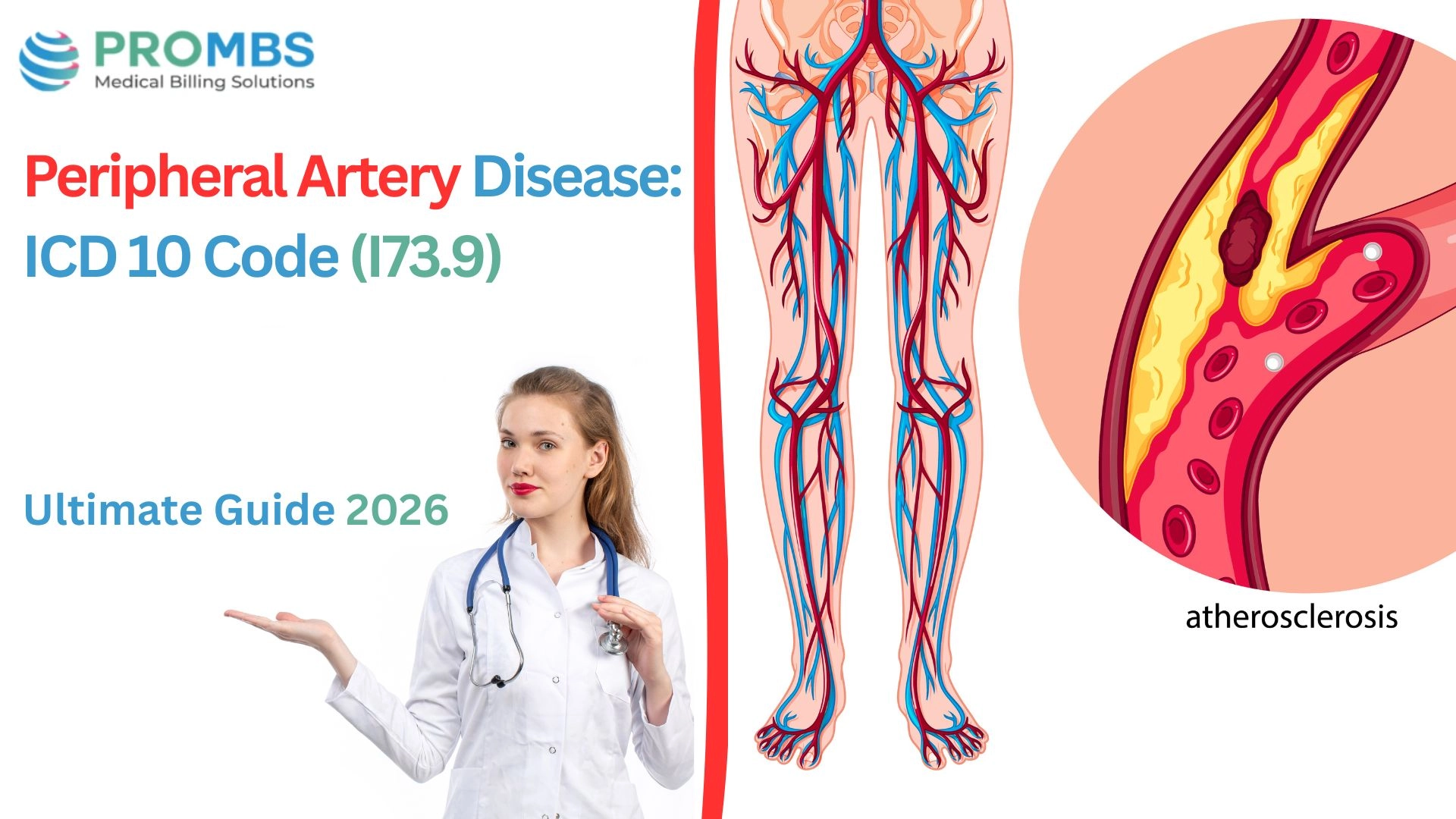 Peripheral Artery Disease ICD 10 Code: Ultimate Guide 2026